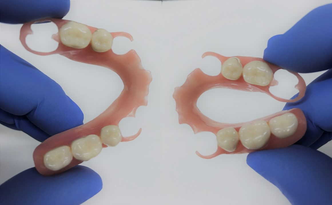 SBC Elastic SBC Elastic